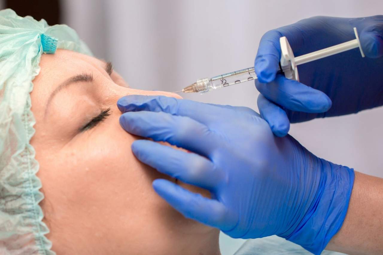Tratamiento de rinomodelación en Barcelona en la clínica de medicina estética Dra. Laura Sitú