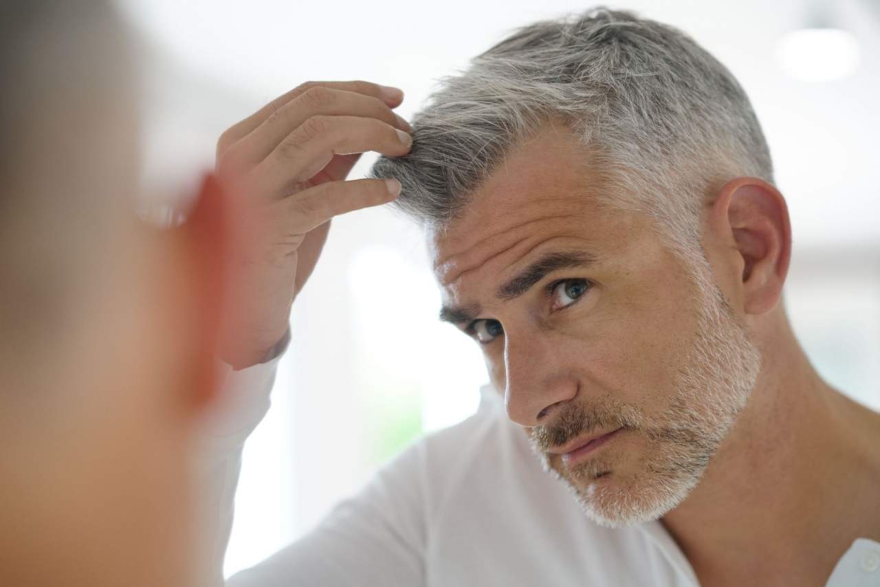 ¿Son las prótesis capilares a medida el futuro?: My Special Hair