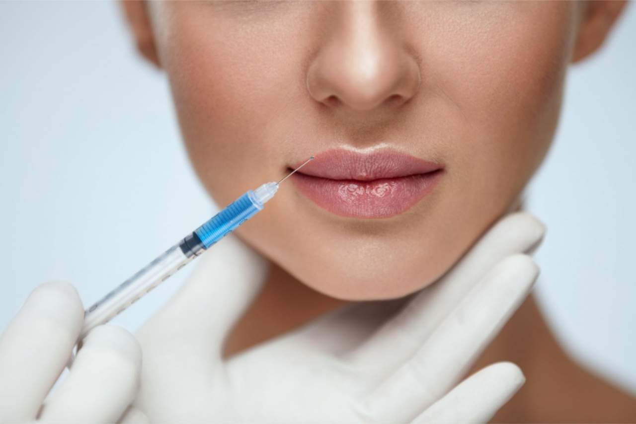 Tratamiento de aumento de labios en la Clínica Dr. Zito