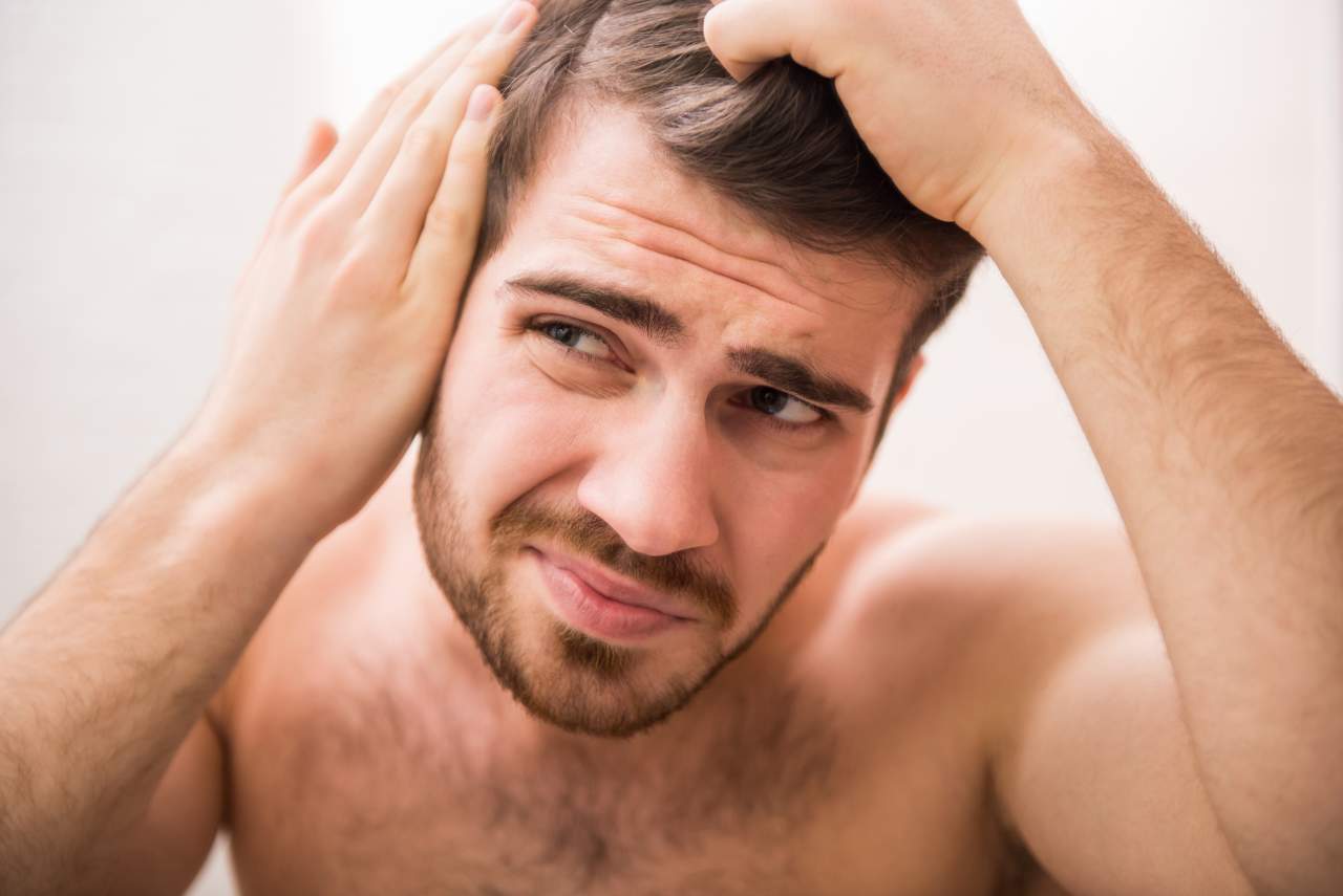 Un 42% de hombres en España son calvos, pero se puede retrasar ese efecto. Método DHI por Dr. Bern Barbehito