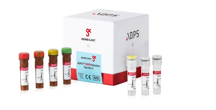 GENECAST inicia una investigación clínica sobre el diagnóstico precoz del cáncer de pulmón con el Samsung Medical Center