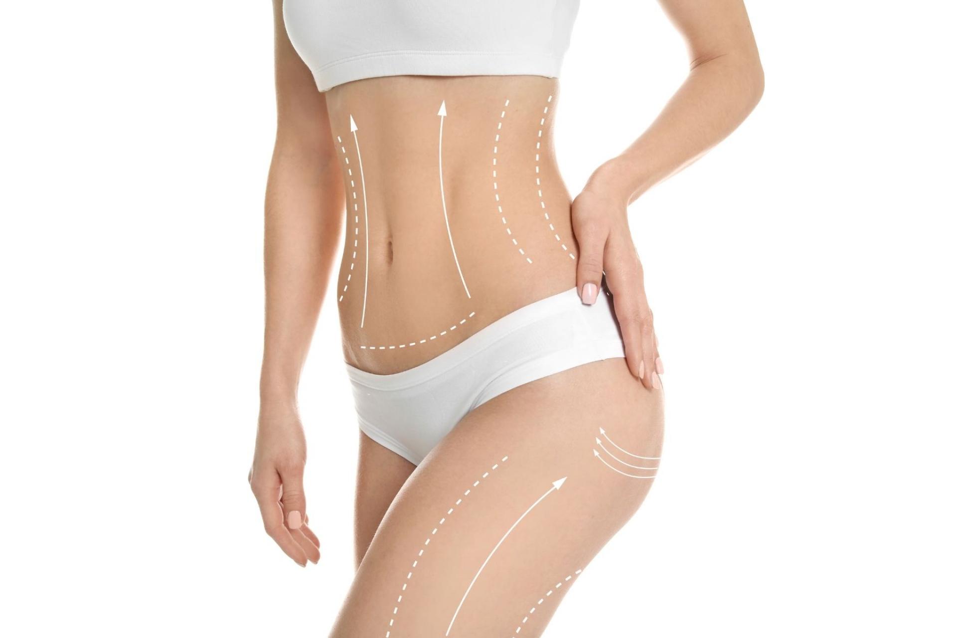 Tratamiento corporal TightSculpting de la Clínica Fercasy