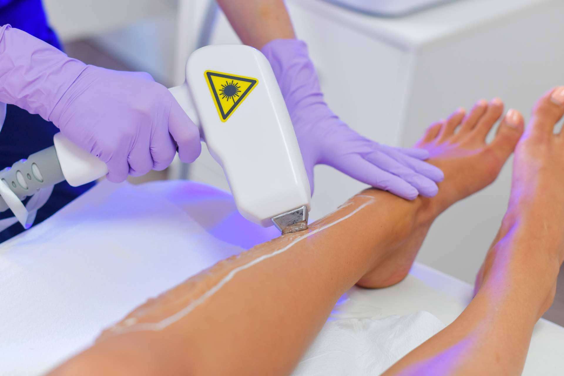 Novedades Estéticas ofrece equipos y productos de estética para profesionales de última generación