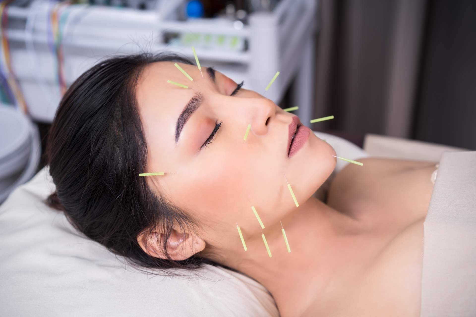 Realizar acupuntura estética a domicilio ya es posible gracias a Kikai