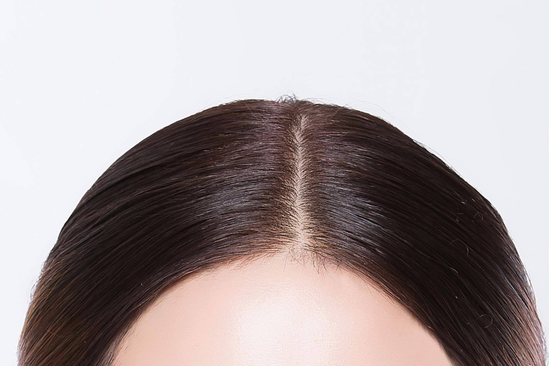 Tratamientos para combatir la descamación y caspa y lucir un pelo sano en el centro de belleza profesional CharoConector