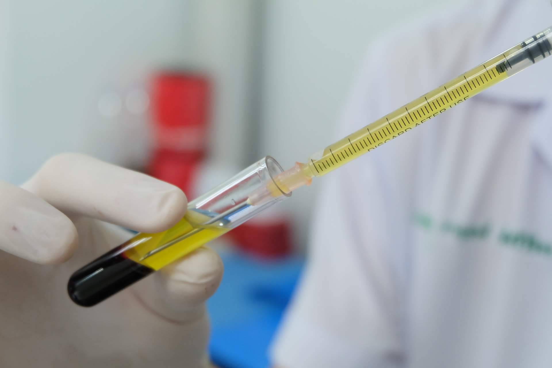 Clínica Estética Alicante Rosa Mora dispone del tratamiento de plasma rico en plaquetas