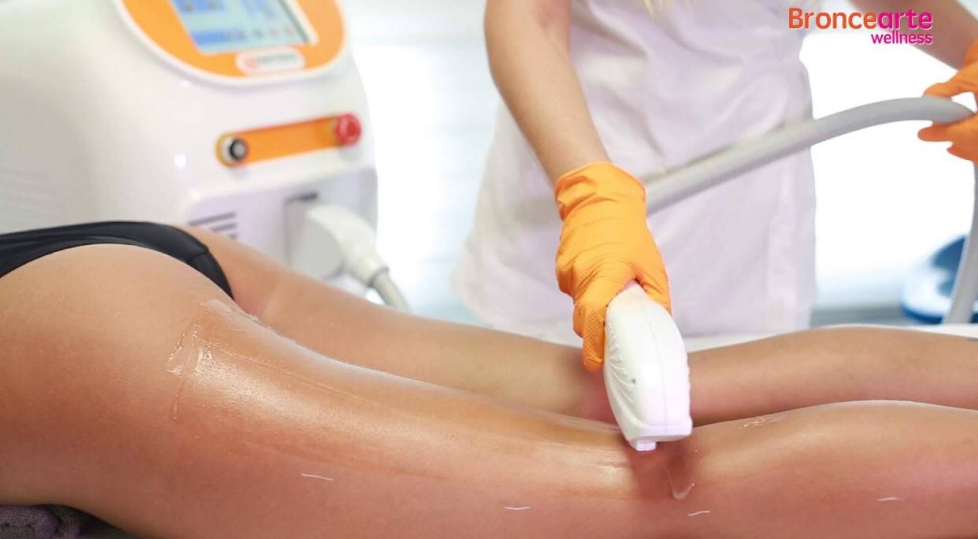 El novedoso sistema de depilación que llega donde otros no lo consiguen, de la mano de Broncearte Wellness
