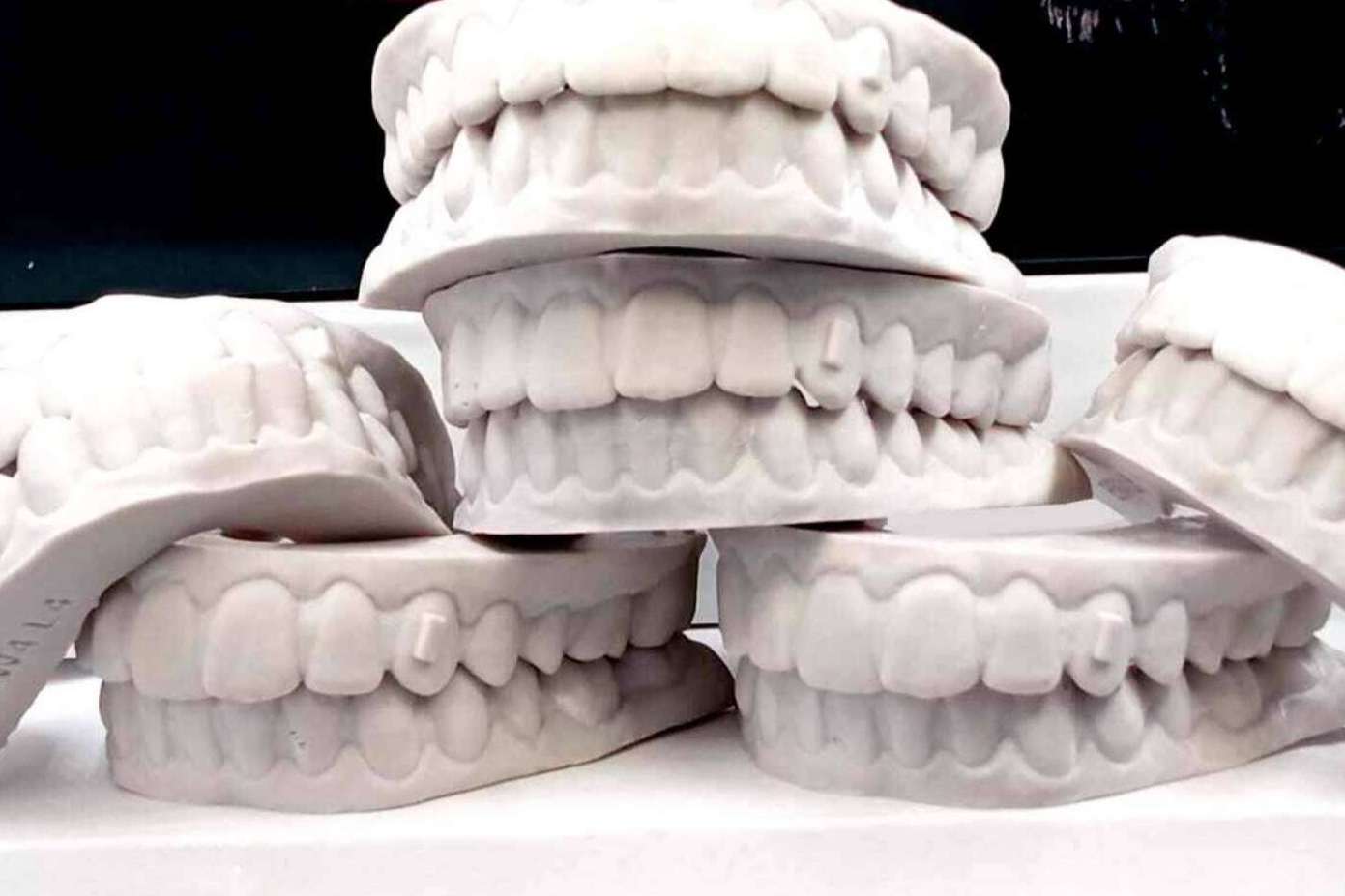Las dudas que suelen surgir sobre la ortodoncia invisible, resueltas por Clínicas Hernadent
