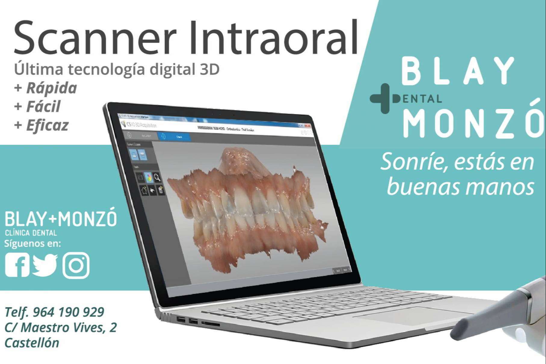 Odontología digital en Clínica Blay Monzó: las técnicas avanzadas en implantología