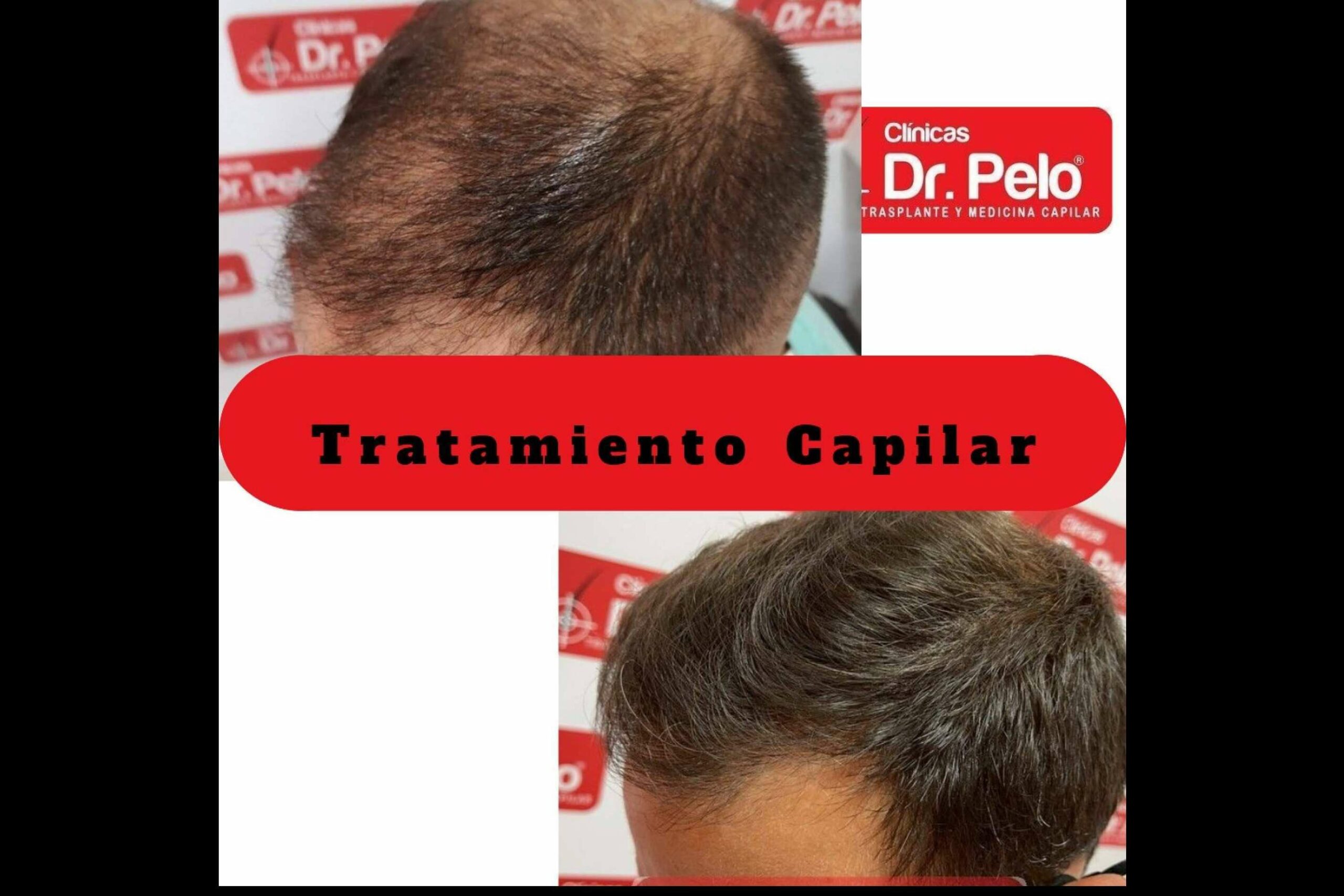 Las Clínicas Dr. Pelo disponen de todo tipo de tratamientos capilares
