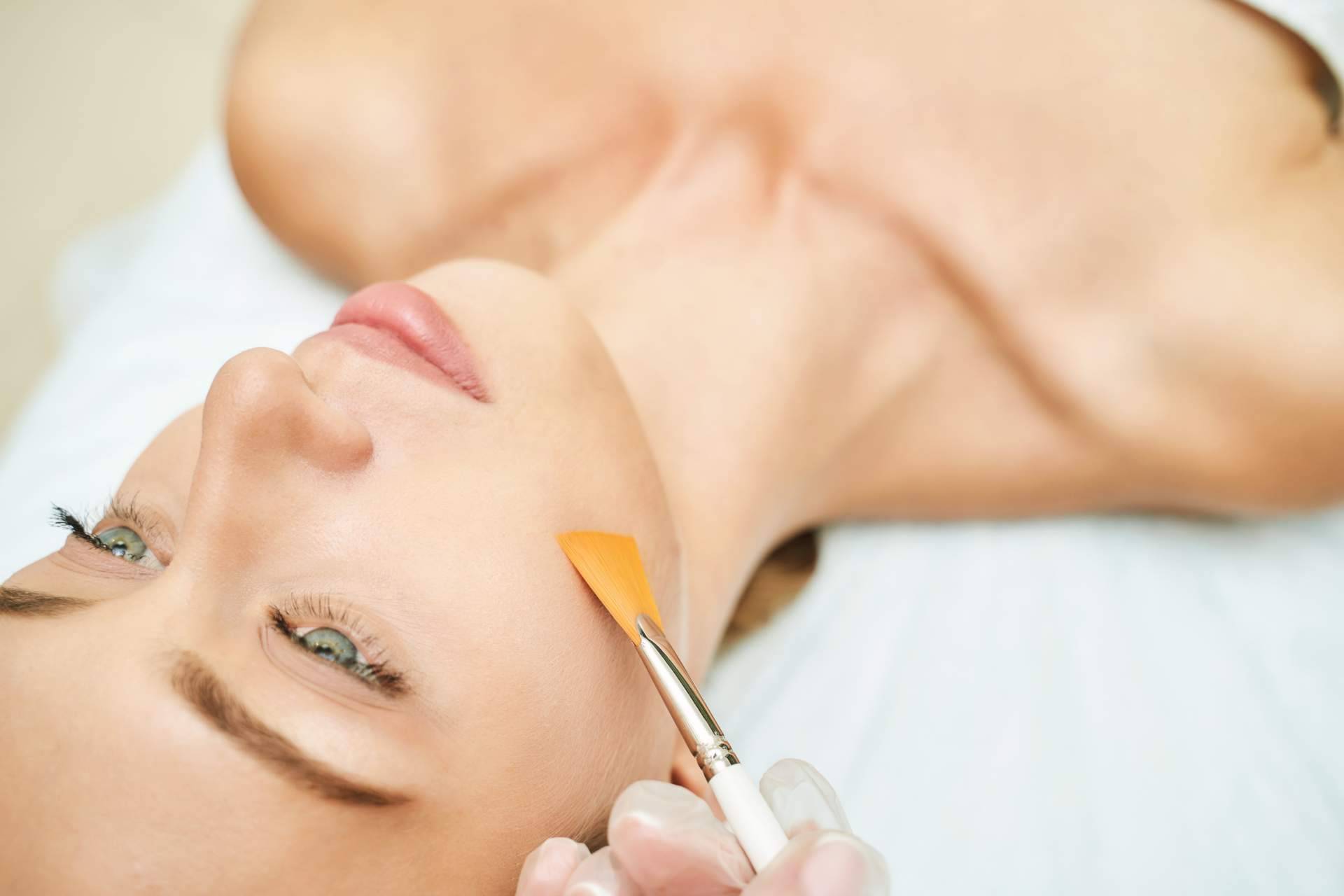 Peeling médico, el tratamiento disponible en Unidad Femme que consigue mejorar la salud y el aspecto de la piel