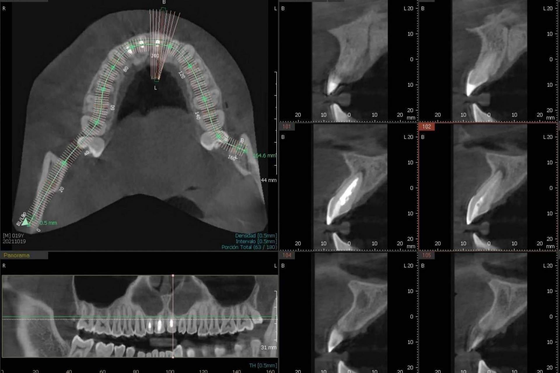 La Clínica Blay+Monzó realiza el innovador CBCT dental 3D