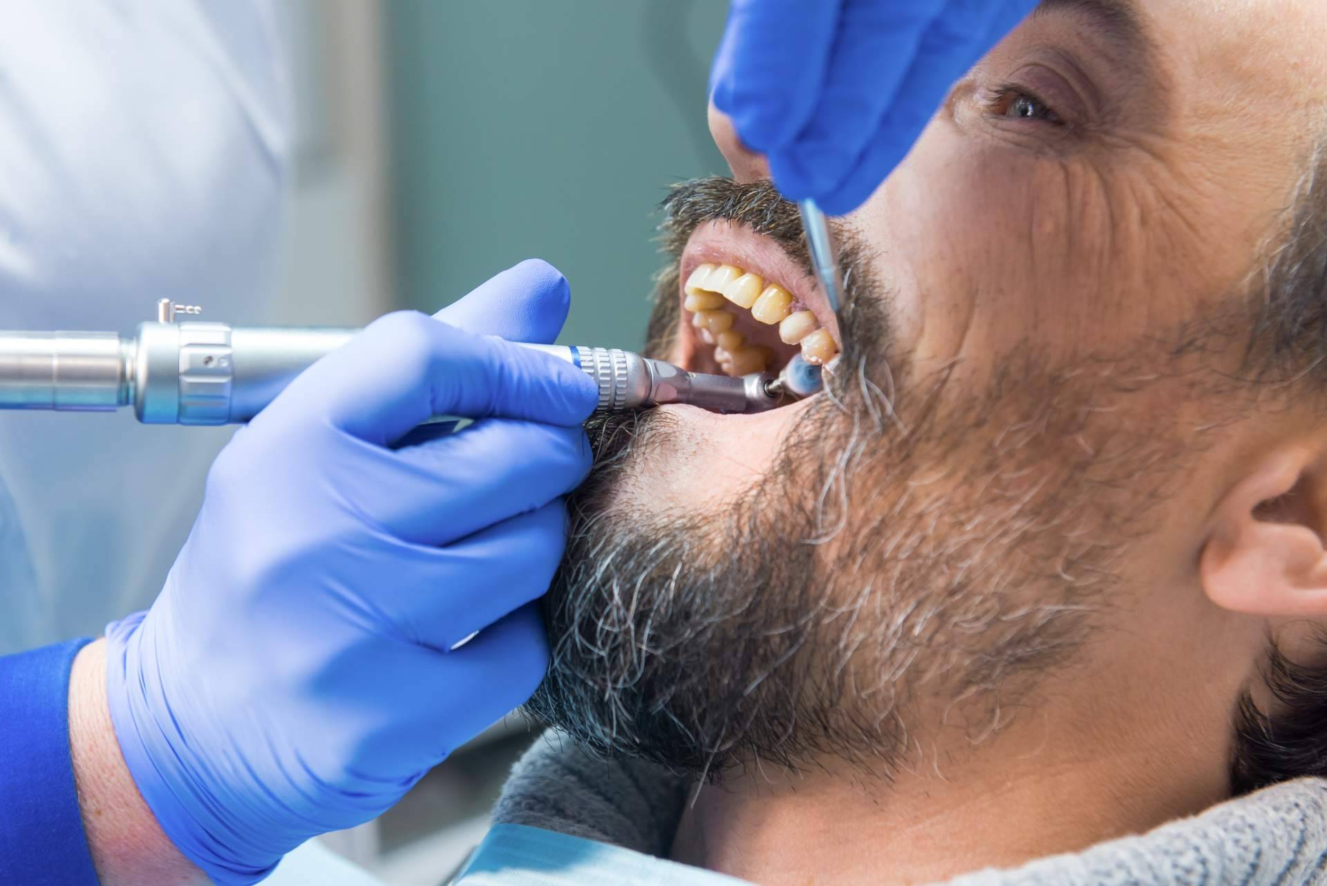 La importancia de las limpiezas dentales profesionales, por Helident Clínica Dental