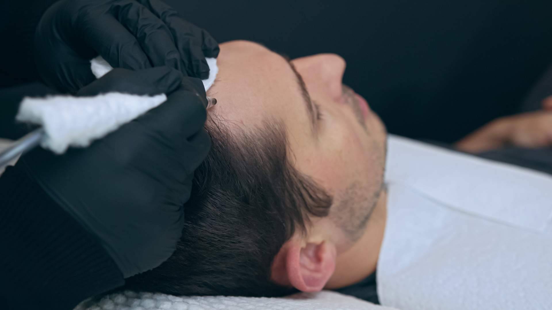 Las Clínicas Dr. Pelo realizan tratamientos de micropigmentación con efecto de redensificación
