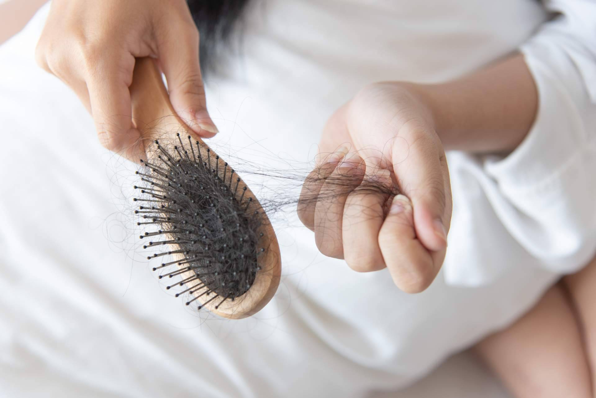 Los tratamientos para la caída del cabello del salón de belleza CharoConector Healthy Style