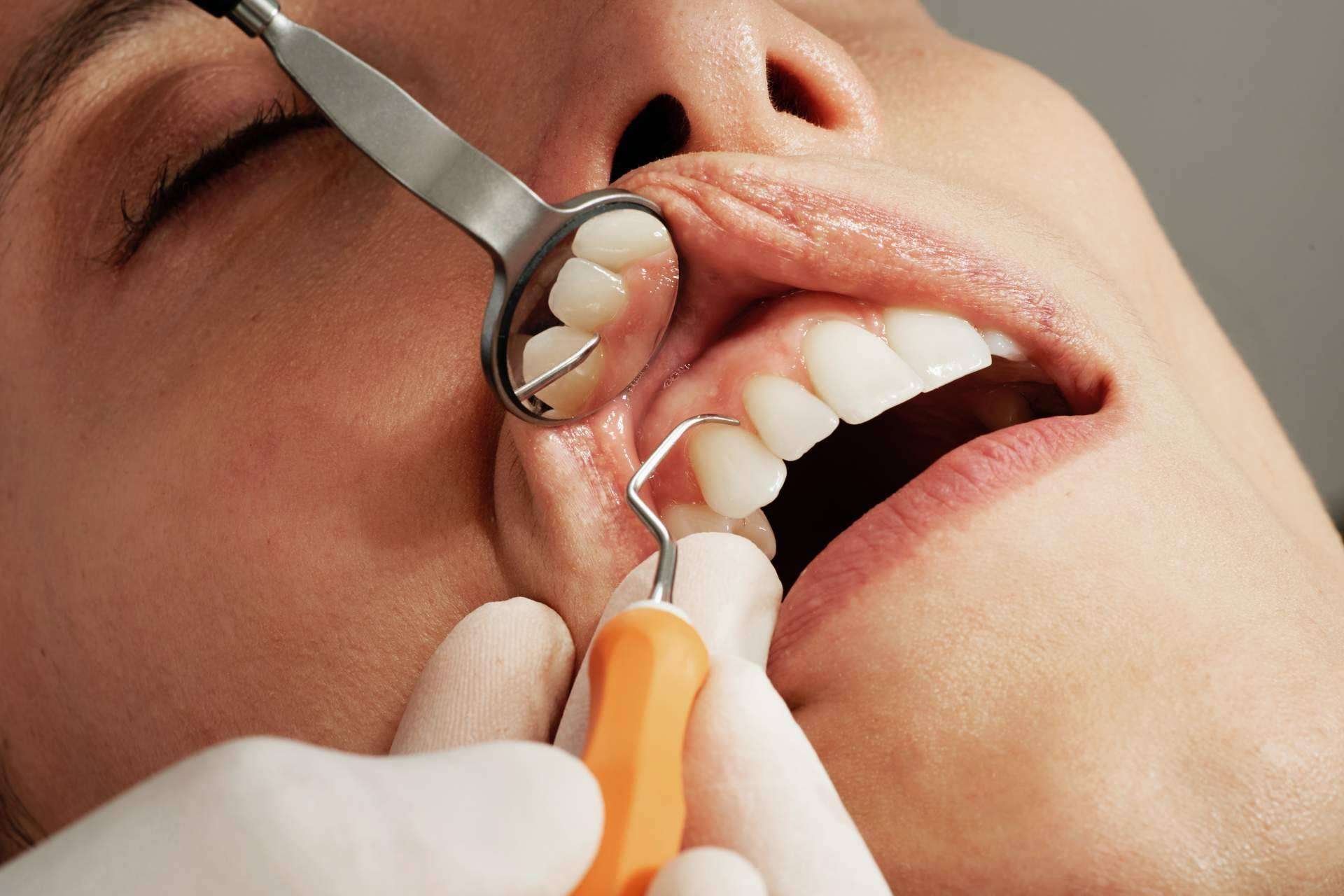 El equipo especializado en periodoncia de la Clínica Sanzmar