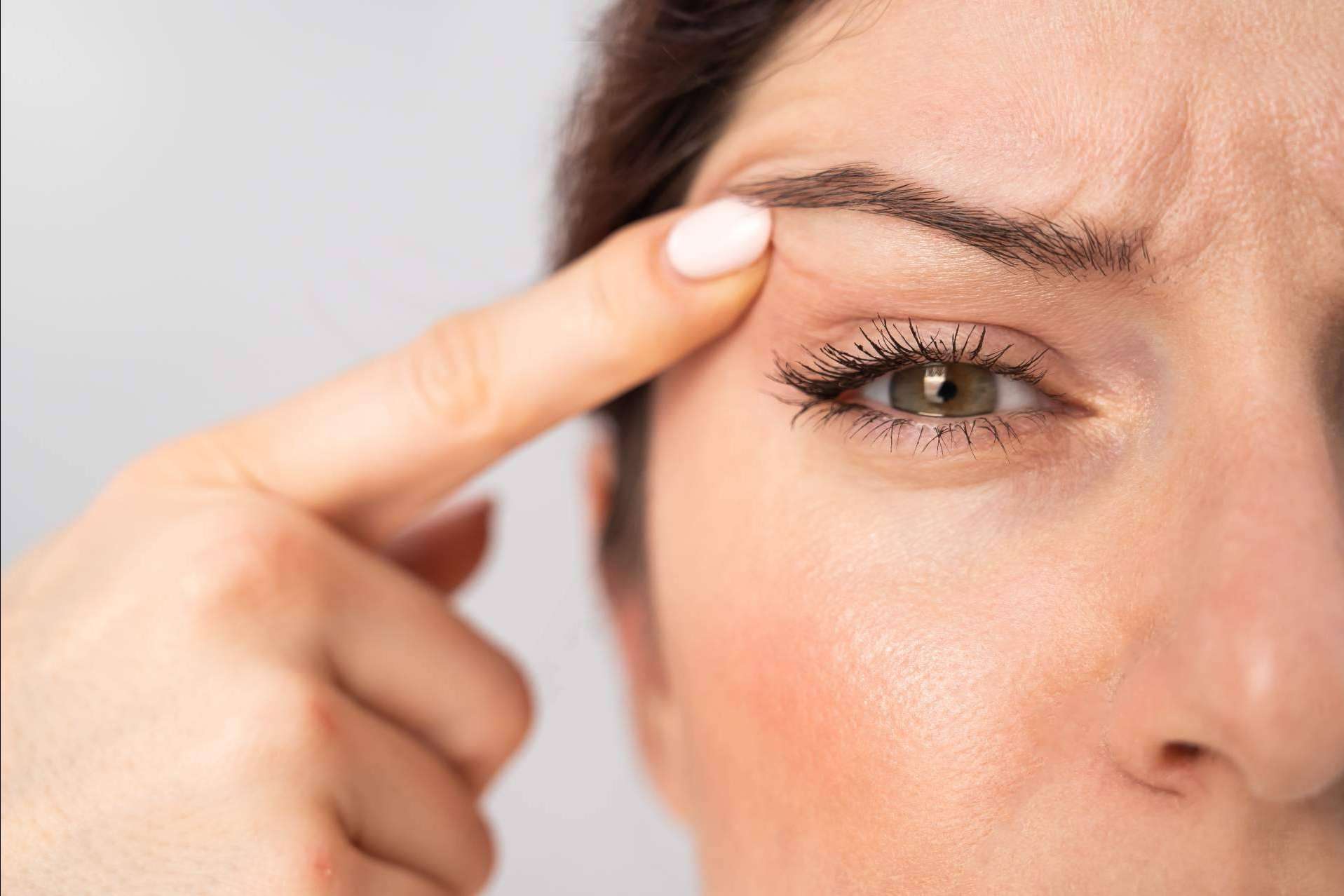 El plasma láser de Alluring Clinic para la blefaroplastia sin cirugía