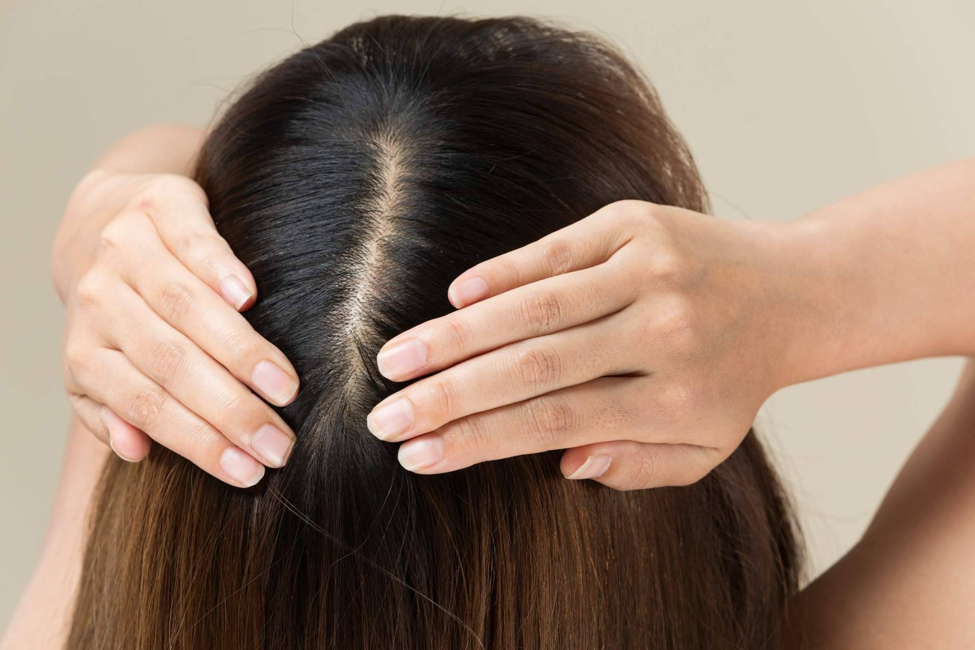 Evitar la caída del cabello y fortalecer los folículos con la solución MHS-Mesohair de DSD de Luxe