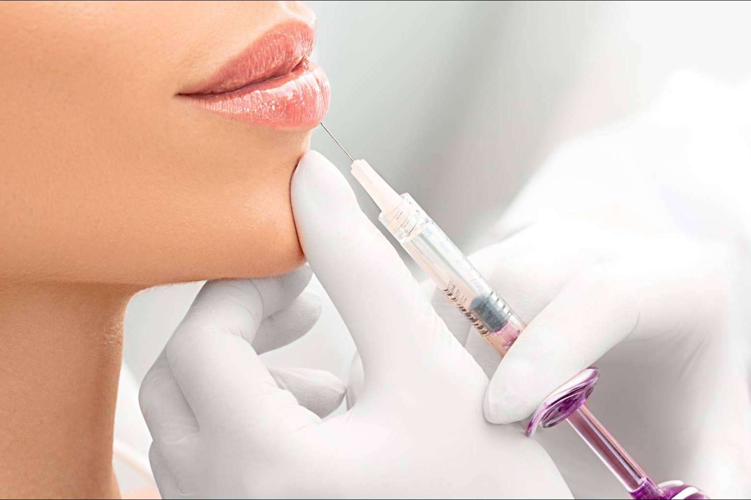 El Dr. Carlos Zito realiza el aumento de labios en Barcelona