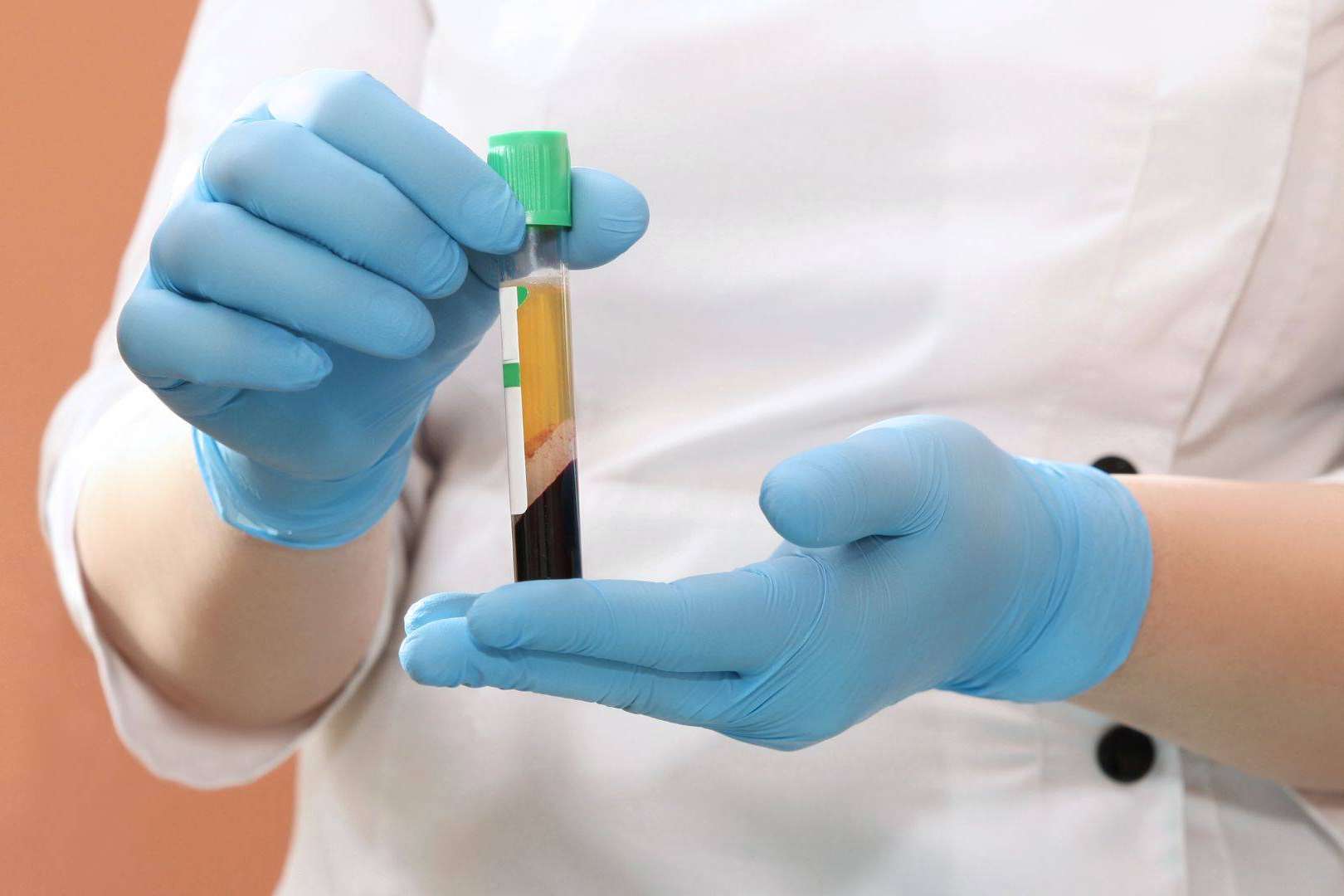 El plasma rico en plaquetas y dutasterida es una potente terapia regenerativa de doble efecto contra la caída del cabello