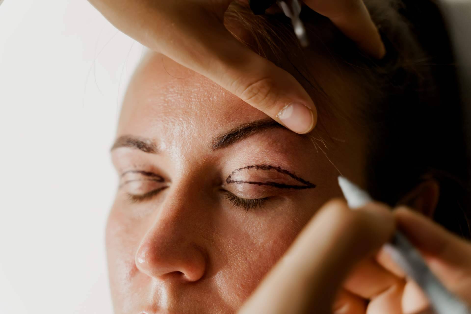 La Clinica de Medicina Estética Elegansse, referente de blefaroplastia mínimamente invasiva de Barcelona