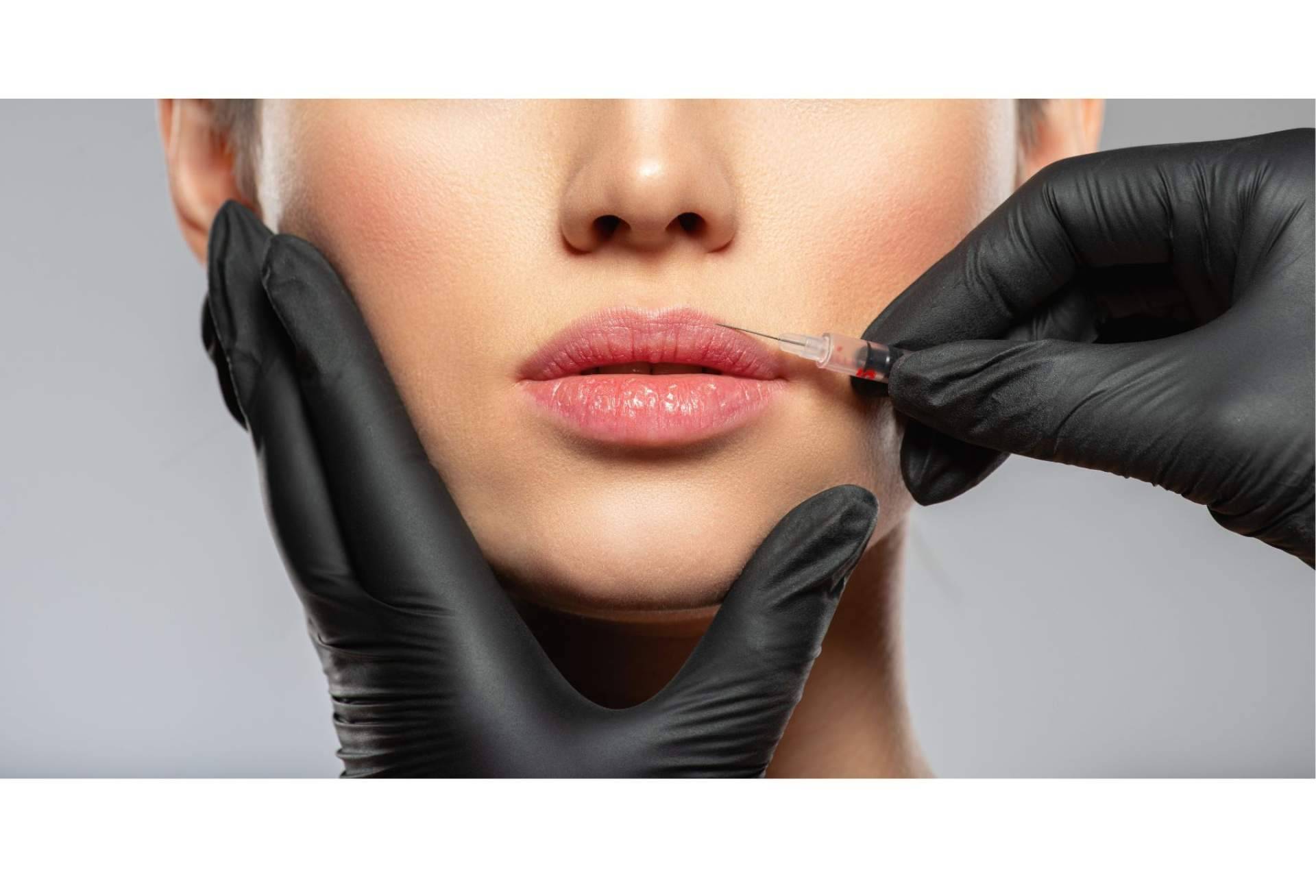Bótox y aumento de labios, el pack más solicitado en 360Clincis