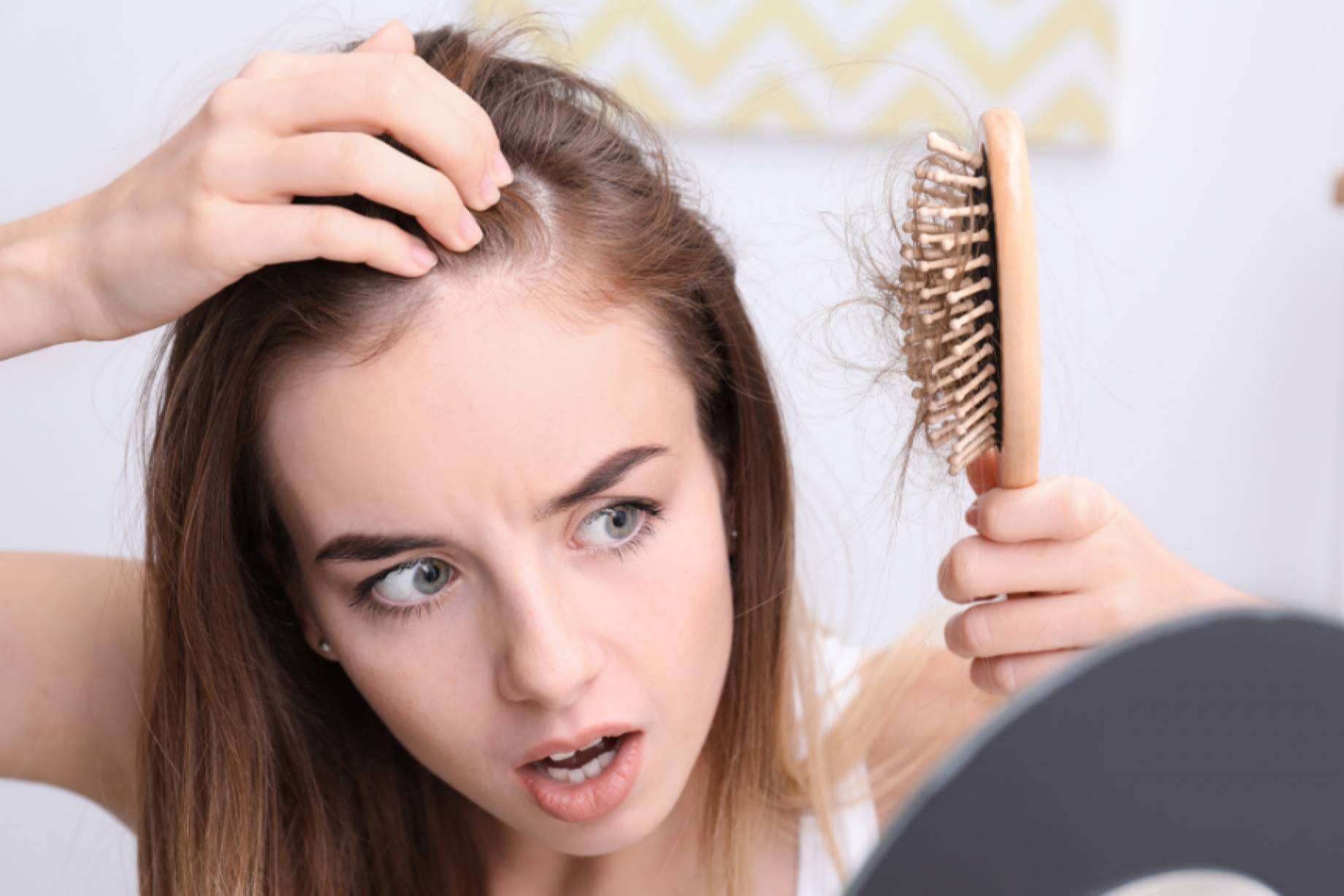 Kmax informa sobre la alopecia femenina, ¿Qué es y por qué se produce?