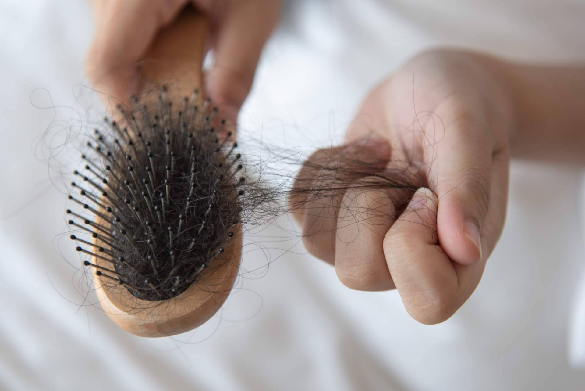 Especialistas en cualquier tipo de alopecia femenina en la clínica Capilar Innovation Clinic