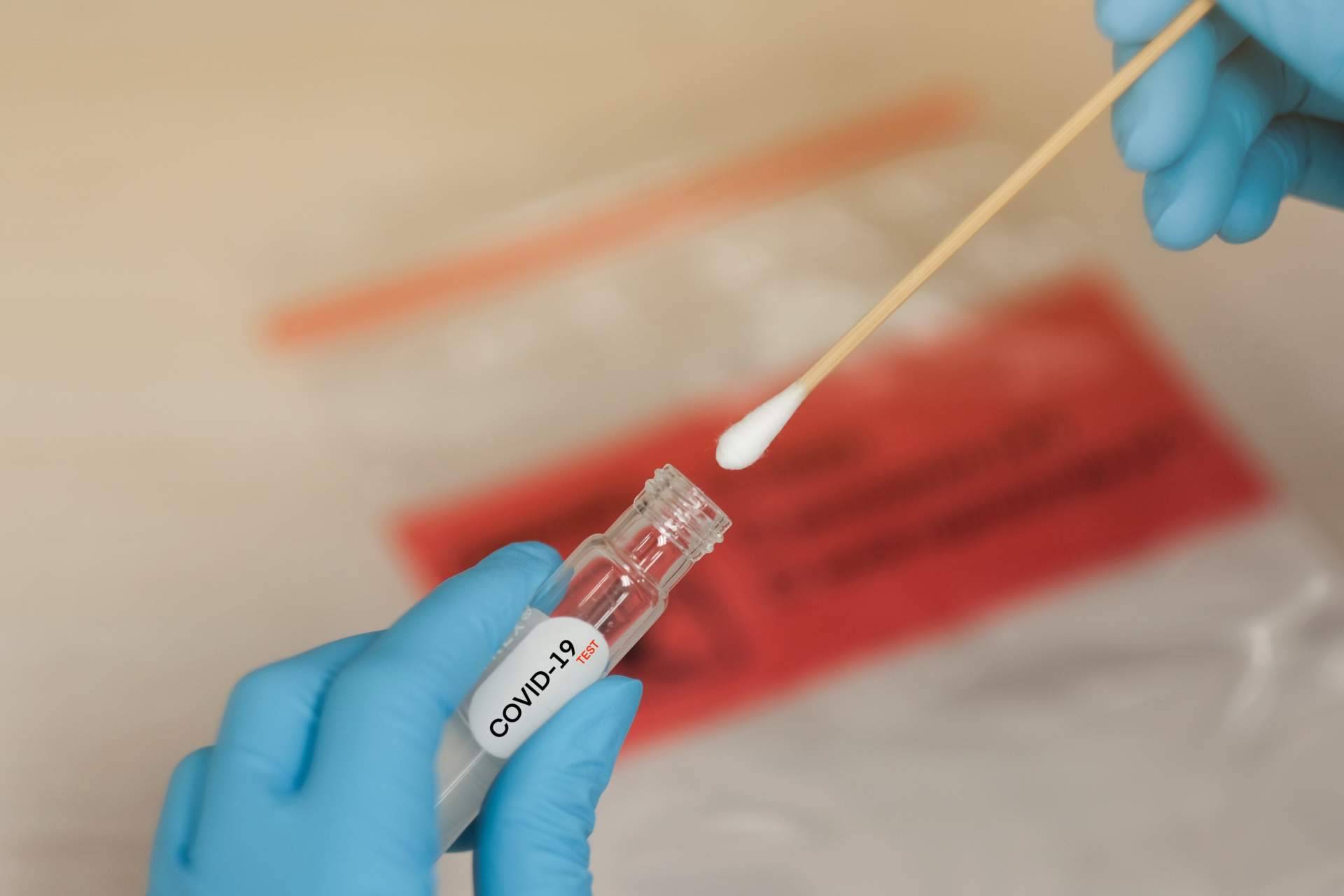 La importancia del test covid en las fiestas navideñas, de la mano de Centro Médico Bravo