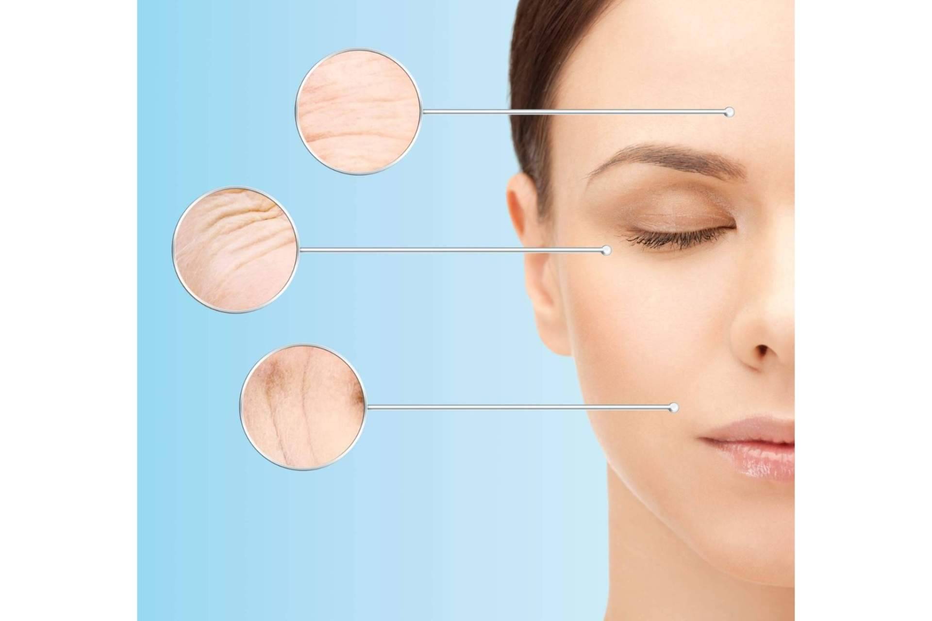 MesoINSTITUTE desarrolla soluciones innovadoras para el cuidado de la piel mediante la mesoterapia facial