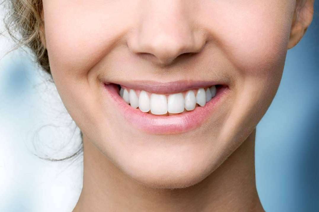 ¿Cómo cuidar los dientes después de un blanqueamiento dental?