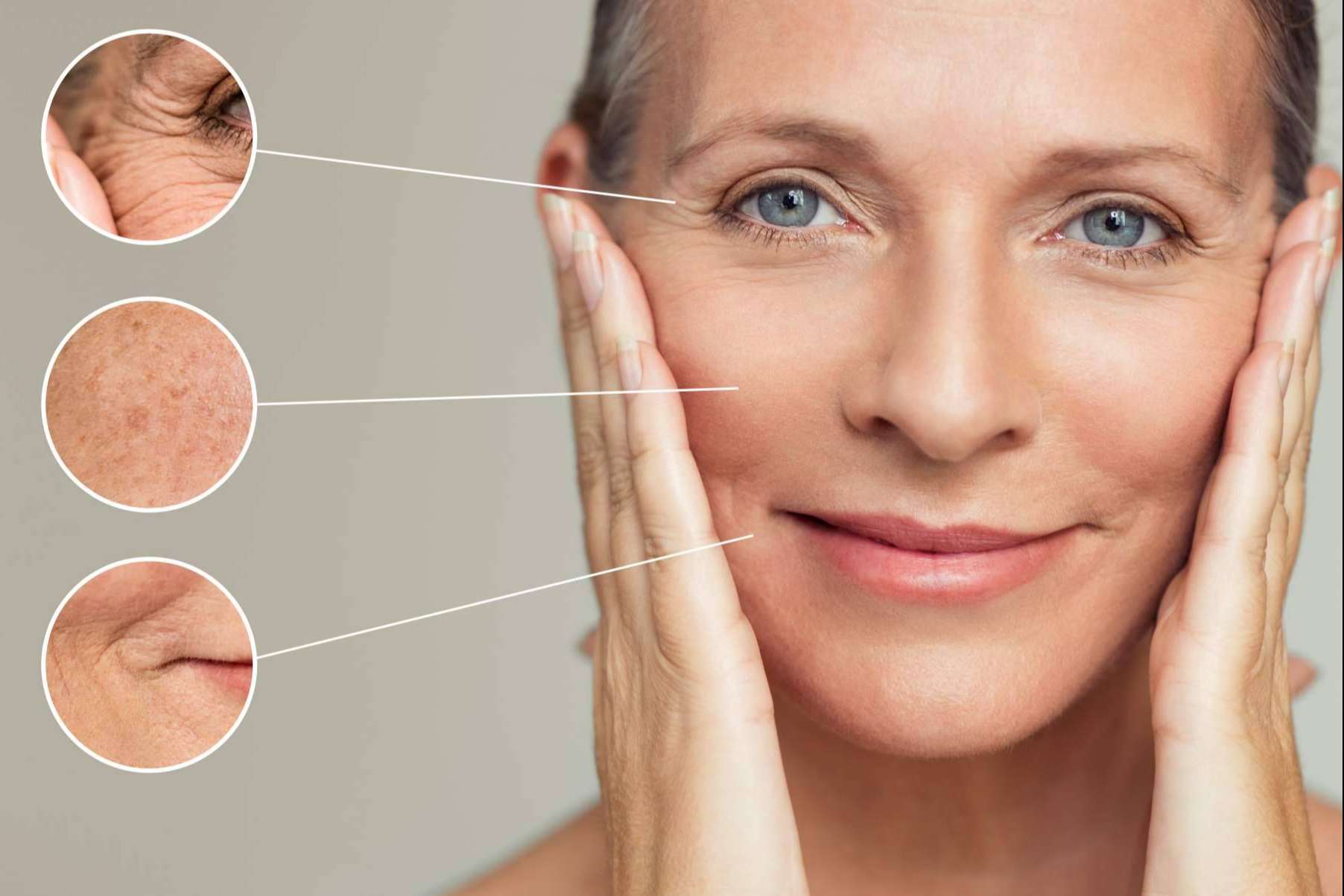 360Clinics y el 'lápiz' que borra arrugas y cicatrices,  Dermapen