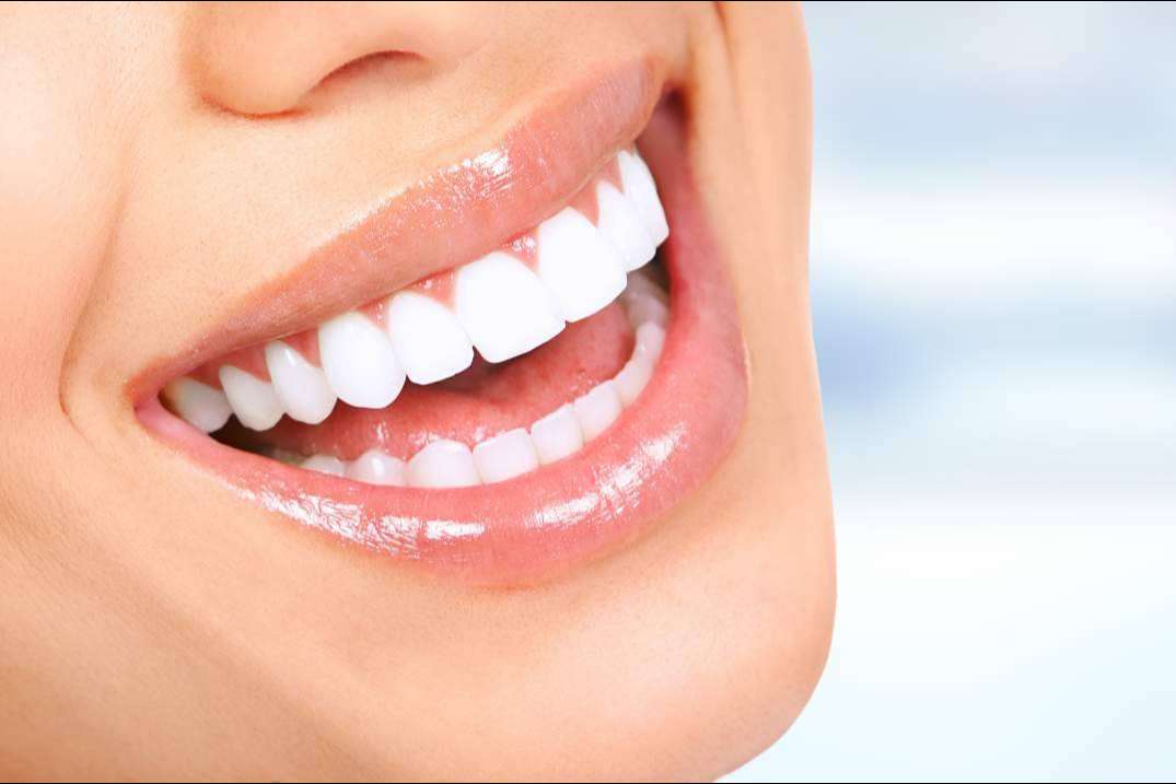 En qué consiste la cirugía de sonrisa gingival