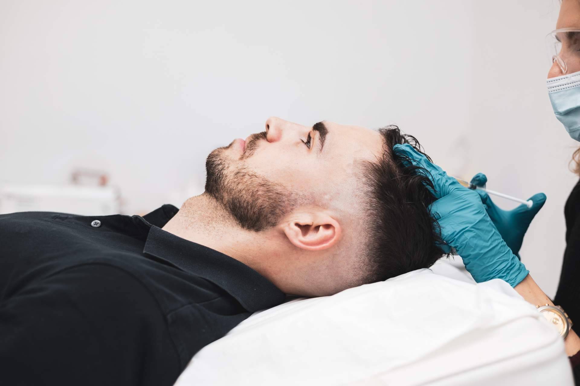 El tratamiento innovador de Centro Estética El Pilar que estimula el crecimiento del cabello, PRP capilar