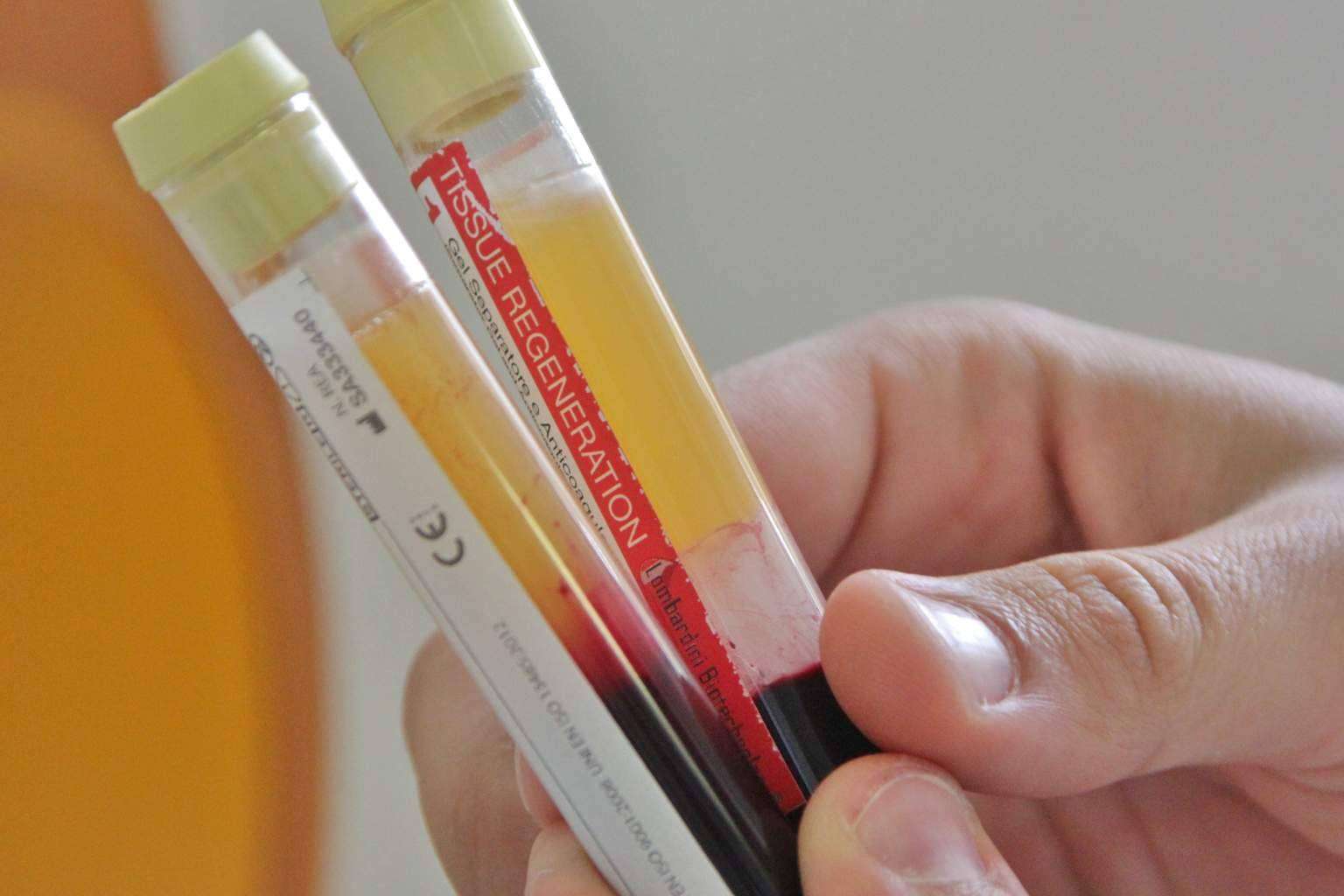 El enfoque implantosofista de Clinica Biorigenera permite volver a sonreír con salud