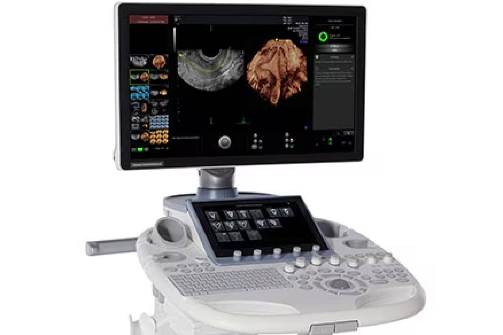 SCP Medical ofrece ecógrafos de última generación y soluciones de diagnóstico por imagen en España