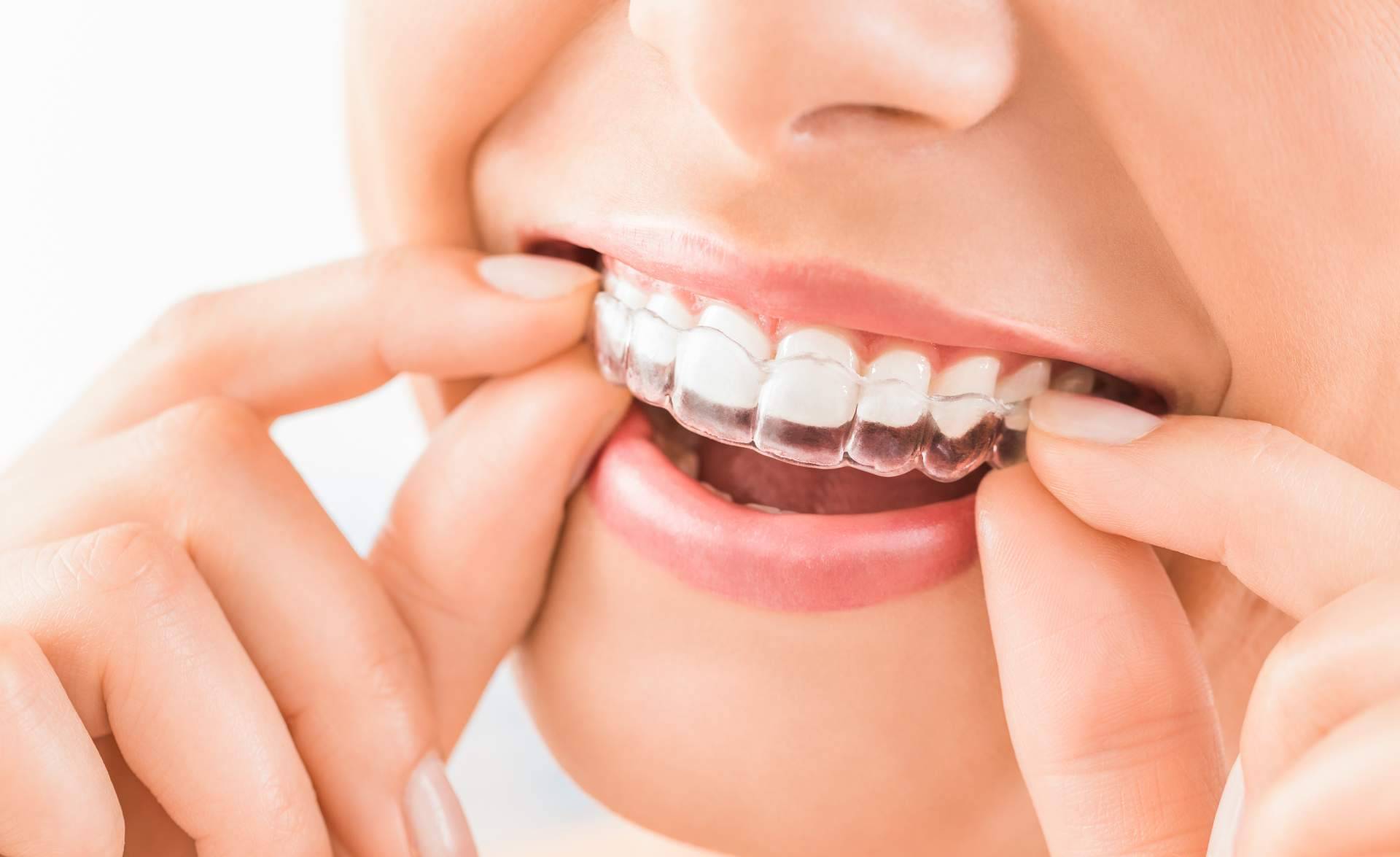 Instituto Dental Oris se consolida como clínica de referencia en implantología y ortodoncia en Zafra y comarca