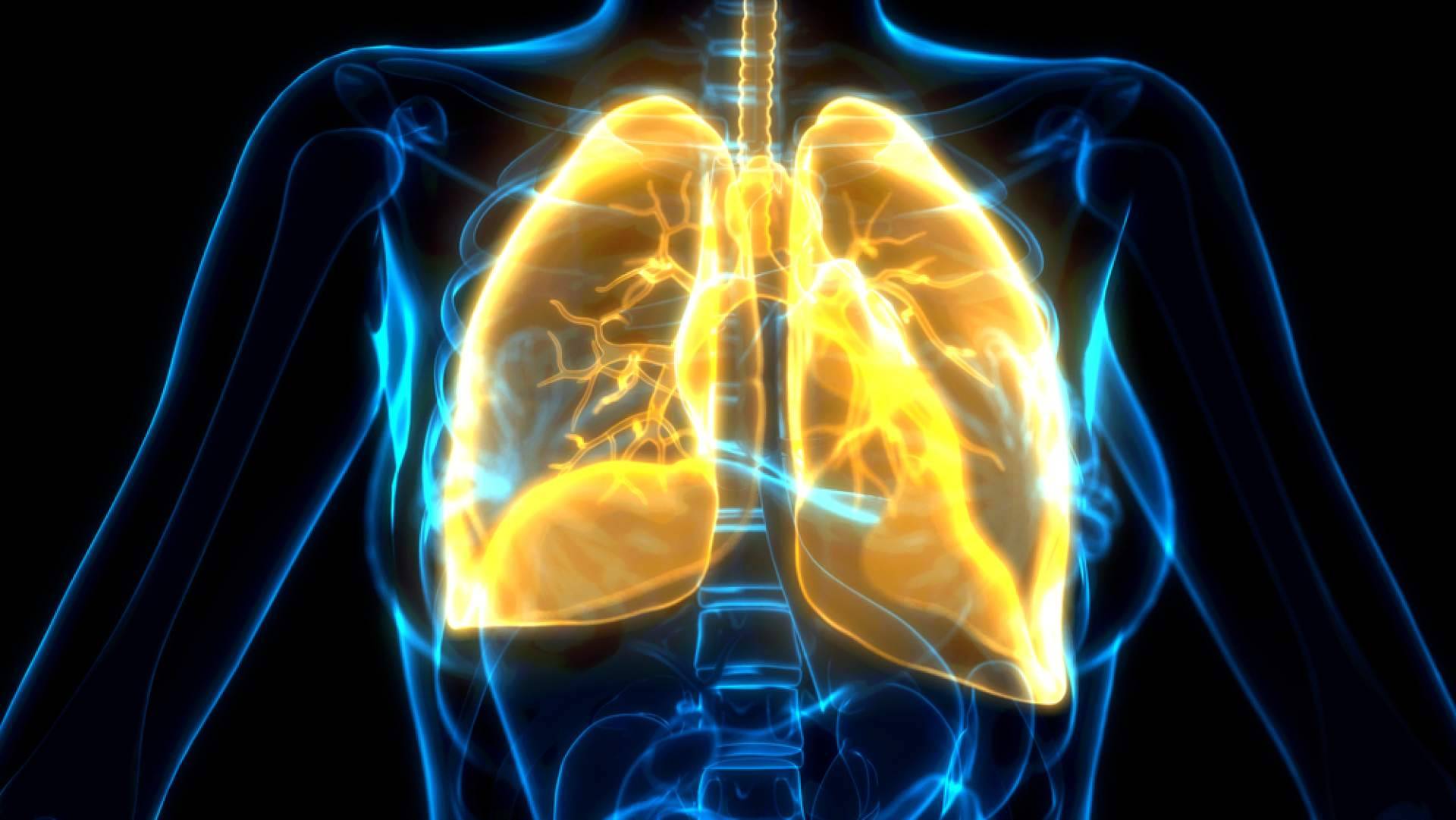 Las bronquiectasias afectan ya a 300 personas por cada 100.000 habitantes en España